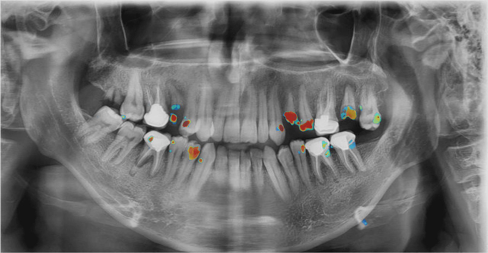 Análise de IA Processada